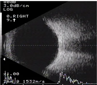 Figure 1. Anterior segment examination on the first day of visit. (A) Slit lamp examination