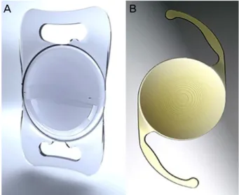 Figure 1. (A) Lentis Mplus LS-313 intraocular lenses (IOL)  and (B) Acrysof Restor SN6AD1 IOL.