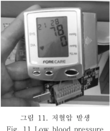 그림  11.  저혈압  발생 Fig.  11  Low  blood  pressure 