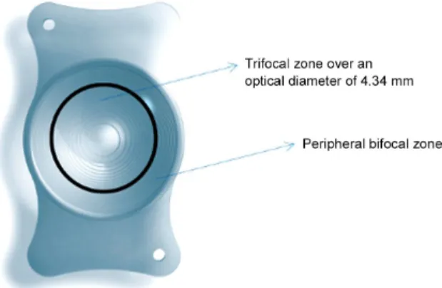 Figure 1. The aspheric diffractive trifocal intraocular lens  (AT.LISA tri839 MP®, Carl Zeiss Meditec, Jena, Germany).