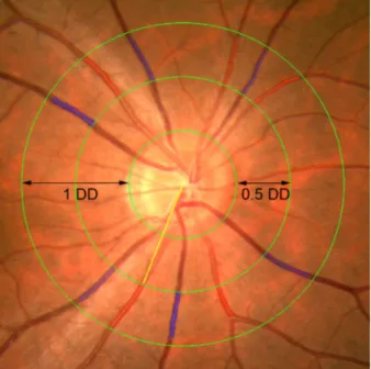 Figure 1. Fundus photograph centered at the optic disc of right  eye, grader analysis measures arteries and veins, the largest  six arteries (red) and veins (blue) are used to calculate the  cen-tral retinal artery equivalent (CRAE) and cencen-tral retinal