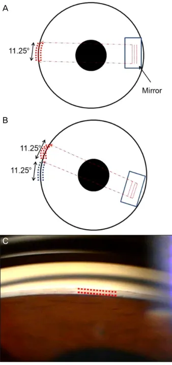 Figure 1. Graphic user interface for patterned laser trabeculo- trabeculo-plasty software.