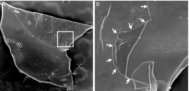 Figure 2. Scanning electron micrographs of the anterior lens capsule after capsulorrhexis at different magnifications