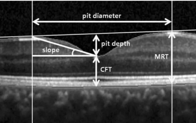 Figure 1. Illustration of the measured parameters. CFT = cen- cen-tral foveal thickness; MRT = maximal retinal thickness.