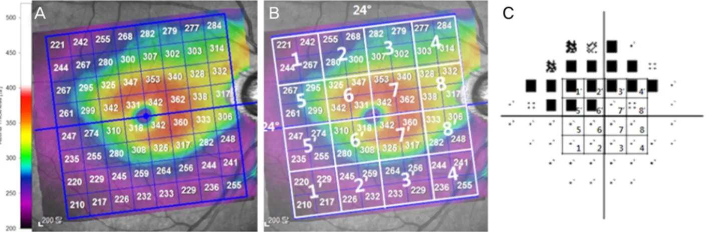 Figure 1. The mean retinal thickness mapping corresponding to the visual field sensitivity
