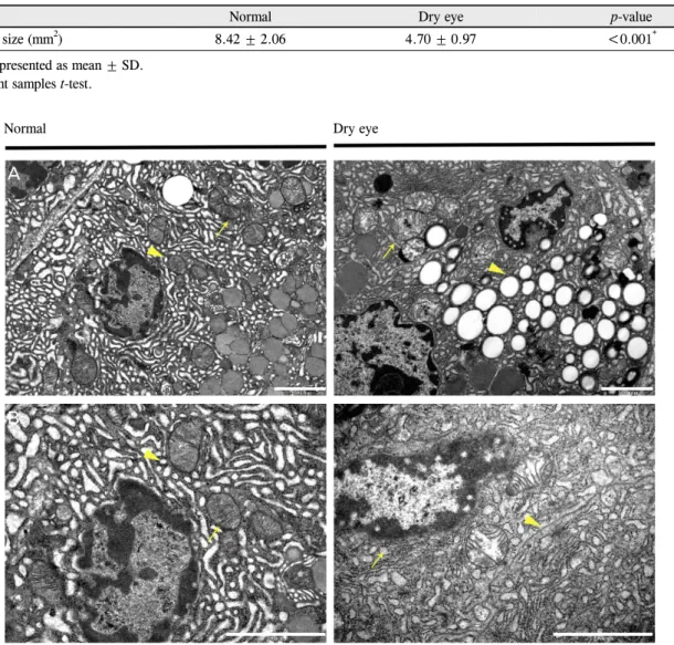Figure 4. Comparison of lacrimal gland cellular structure between normal mice and dry eye (DE) induced  mice under Transmission Electron Microscopy (TEM)
