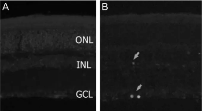 Figure 3. Increased intraocular pressure (IOP) mediated apop- apop-totic cell death. (A) There was no TUNEL-positive cells in the  retina of control mice treated with artificial tears