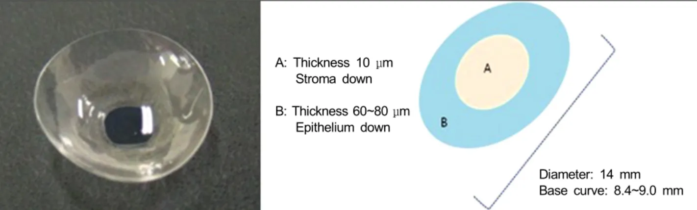 Figure 1. The structure of amniotic membrane contact lens. 다.  소양막콘택트렌즈의  직경은  14  mm이며,  곡률반경은  8.4-9.0  mm,  함수율은 65-75%이다