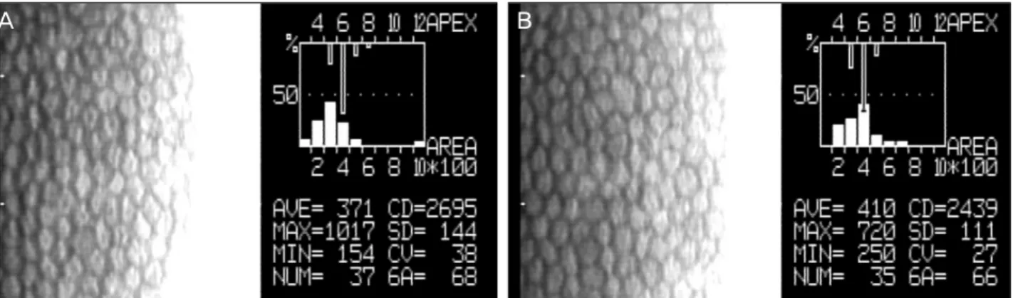 Figure 6. Baseline endothelial cell profile analyzed with specular microscope was not different between the Y-27632 group (A) and  the control group (B).