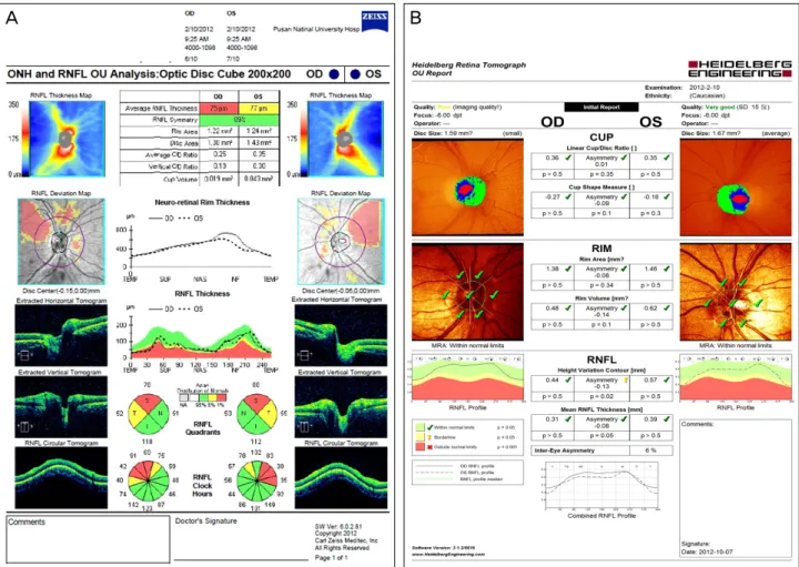 Figure 2. Optical coherence tomography (OCT) (A) and Heidelberg retinal tomography (HRT) (B)