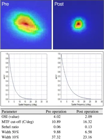 Figure 3. A representative OQAS result of a patient. 