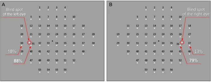 Figure 5. The rates of missing targets near the blind spots at the left eye (A) and right eye (B).