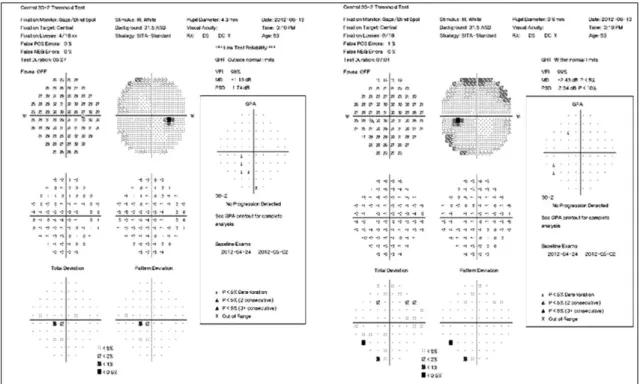 Figure 5. VF showing no visual field defect in both eyes after 7 weeks.