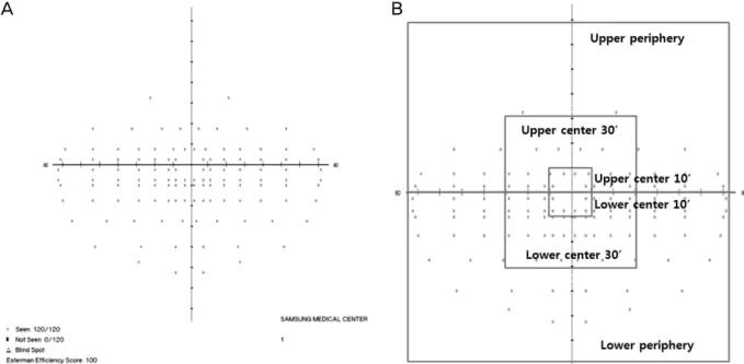 Figure 1. (A) Binocular Esterman visual field. Sixty patients who had bilateral visual field defect underwent binocular  Esterman visual field test