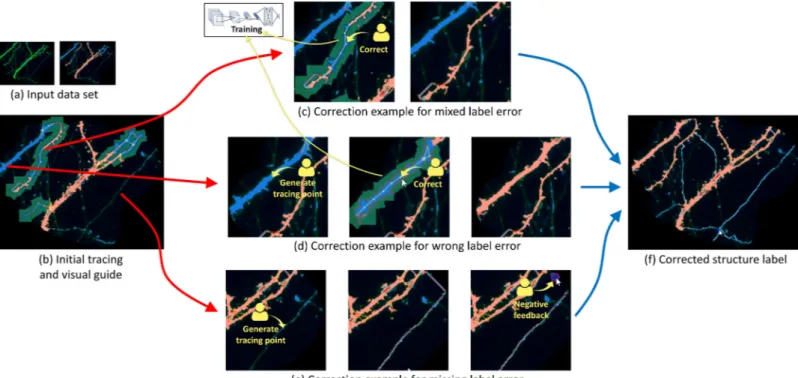 Figure 7: Examples of neuron structure proofreading workflow through the proposed method - (a) input dataset, (b) visual guide through initial neuron tracing and structure classification prediction, (c,d,e) error correction scenarios through user feedback,