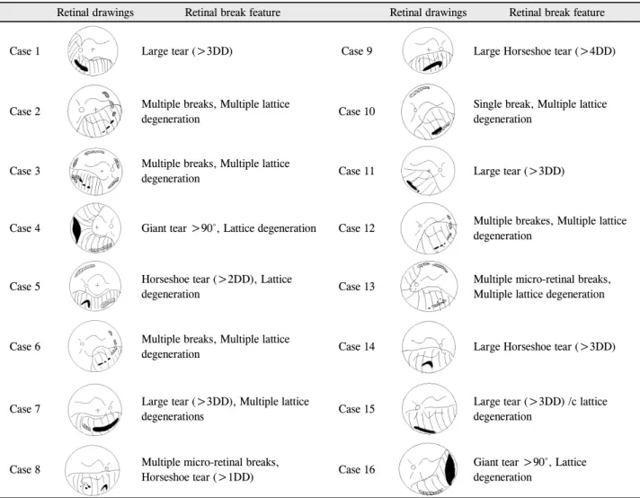 Table 2. Retinal drawings and retinal breaks features – (Group 1: 23G PPV, silicone oil tamponade)