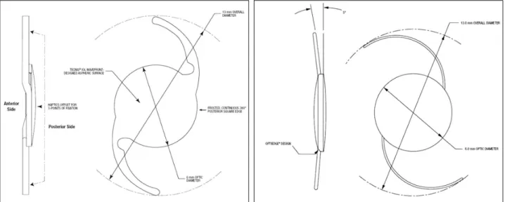 Figure 1. Comparison of single piece IOL (Tecnis® ZCB00) and three piece IOL (Tecnis® ZA9003)