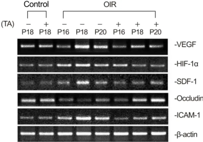 Figure 3. Expression of mRNAs analyzed by RT-PCR in the  retina of both control and OIR rats and changes after TA  treatment