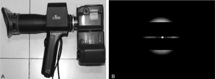 Figure 1. Light-amplification pupillometer (Colvard pupillometer®, OASIS medical, USA) attaching digital camera (A), and pic- pic-ture of the pupil with the digital camera (B).