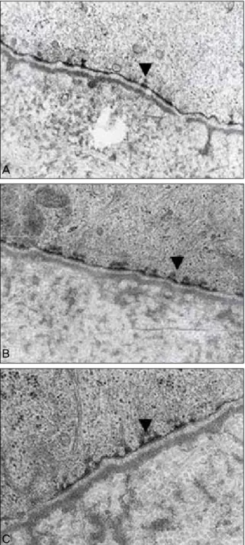 Figure 7. Transmission electron photomicrographs (original  magnification ×45,000) of the central cornea at 4 weeks