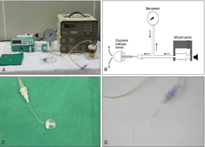 Figure 2. (A) Closed manometric apparatus to measure intraluminal pressure in the tube of glaucoma drainage devices (GDD)