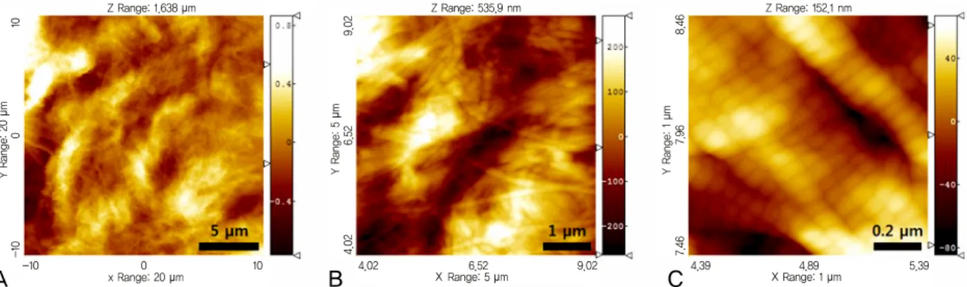 Figure 2. Representative atomic force microscopy topography images of the dehydrated human sclera in various scan sizes such as  (A) 20 × 20 µm 2 , (B) 5 × 5 µm 2 , and (C) 1 × 1 µm 2 .