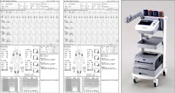 Figure 1. Pulse wave analyzer and report of the result. Brachial-ankle pulse wave velocity was measured with a volume-plethysmo- volume-plethysmo-graphic apparatus (automatic waveform analyzer: VP-1000, Colin Co, Komaki, Japan)