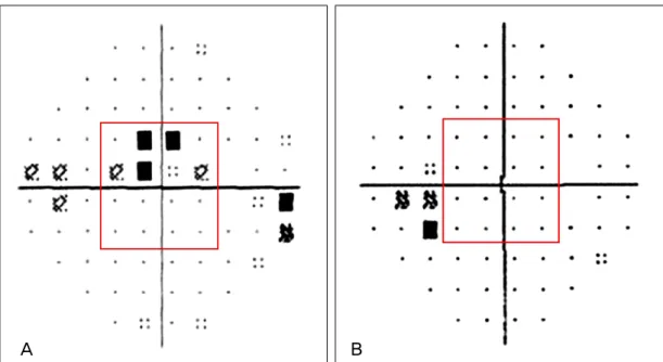 Figure 1. Visual field tests of central and peripheral visual field defect (VFD) groups