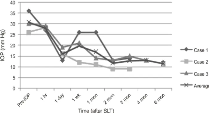 Figure 1. Effects of selective laser trabeculoplasty in 3 patients  with elevated IOP after intravitreal triamcinolone acetonide