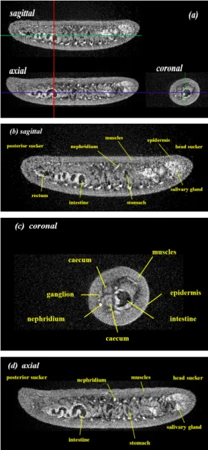 그림 4. A negative phase-contrast X-ray tomography  image (a) tomography image (b) sagittal  image (c) coronal image (d) axial imag