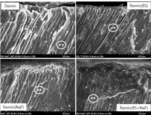 Fig. 1. The image of demineralized enamel subsurface and remineralization solution treated enamel  subsurface (arrows: enamel crystal width)