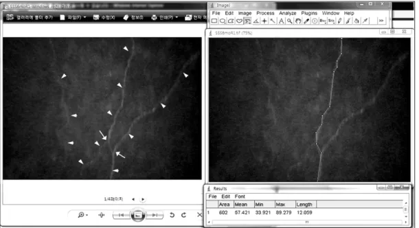Figure 1. The analysis of corneal subbasal nerve plexus using ImageJ software. A winding line of corneal nerve  is visualized in the left original photograph and the nerve length was analyzed by “segmented line length  analy-sis tool” in ImageJ software by