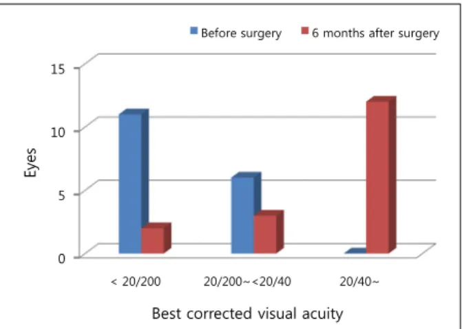 Figure 1. The pre- and post-operative visual acuity.