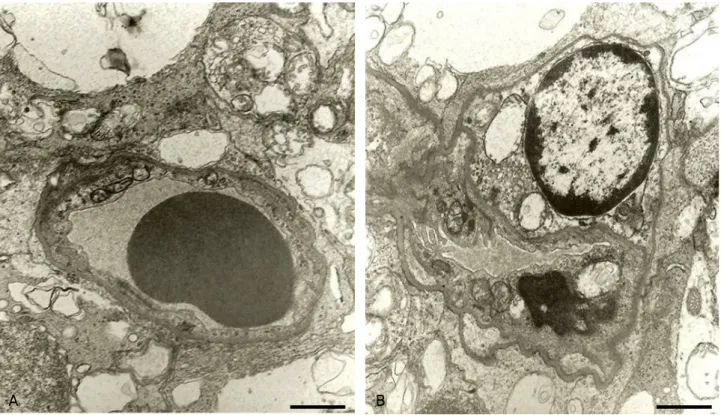 Figure  1. Electron  micrographs  of  the  outer  plexiform  layer  of  a  50-weeks-old  LETO  (A)  and  OLETF  rat  (B)