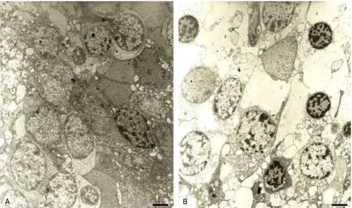 Figure  2. Electron  micrographs  of  the  inner  nuclear  layer  of  a  50-weeks-old  LETO  (A)  and  OLETF  rat  (B)