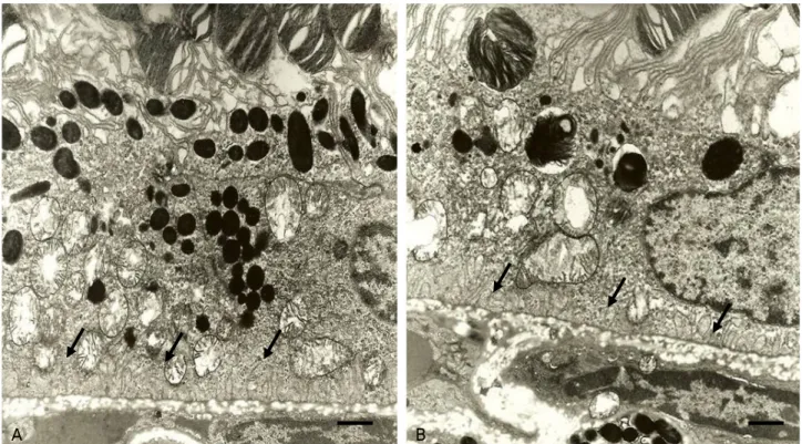 Figure 4. Electron micrographs of the retinal pigment epithelium containing the basal infoldings of a 50-weeks-old  LETO  (A)  and  OLETF  rat  (B)