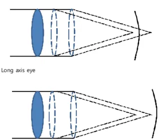 Figure 4. Large refractive change can be caused more  in  short  axis  than  in  long  axis  eyes.