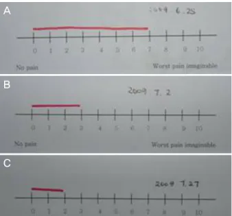 Figure  1. Patient  was  asked  to  check  the  degree  of  subjective pain using the visual analogue scale at  dif-ferent  visiting  time  (0;  no  pain,  10;  Worst  pain  that  can  imagine)
