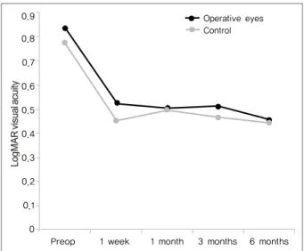 Table  3. Difference  in  CMT  after  cataract  operation  from  preoperative  CMT