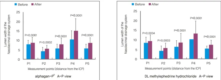 Figure 3. Comparison of the lumen widths of the nasolacrimal drainage system at 5 points before and after Alphagan-P Ⓡ  and DL  methylephedrine hydrochloride irrigations.