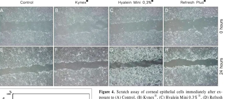 Figure 5. Flow cytometric analysis of apoptotic cells using Annexin V FITC after 4-hour exposure to (A) Control, (B) Kynex Ⓡ , (C)  Hyalein Mini 0.3% Ⓡ , (D) Refresh Plus Ⓡ  and after 24 hours exposure to (E) Control, (F) Kynex Ⓡ , (G) Hyalein Mini 0.3% Ⓡ 