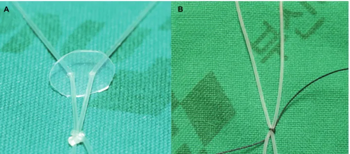 Figure 1. A tie made at the silicone silastic sheet by using silicone tube (A), and a tie made by Nylon 6-0 (B).