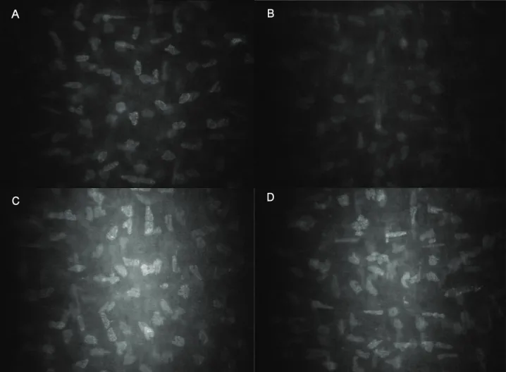Figure  3. Confocal  microscopy  images  of  the  middle  and  posterior  stromal  layer  of  the  cornea  in  the  control  (A,  C)  and  corresponding  post-PRK  corneas  (B,  D)