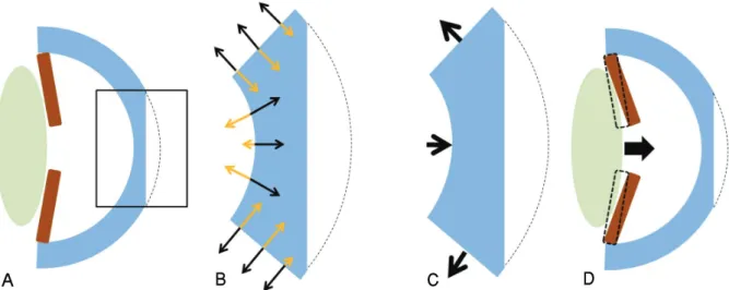 Figure 4. The schematic figures of change of the cornea after LASEK surgery.  (A) Section of cornea during LASEK surgery