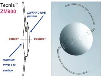 Figure 1. The design of Tecnis ZM900 aspheric multifocal intraocular  lens. 대상과 방법 2007년 10월부터 2008년 3월까지 본원 안과에서 백내 장으로 진단받고 수술 받은 환자 중 Tecnis ZM900을 삽입 한 환자 11명 20안(다초점군)과 Tecnis ZA9003을 삽입한  환자 20명 20안(대조군)을 대상으로 연구를 진행하였으며,  연구는 전향적 방법으로 진행하였다