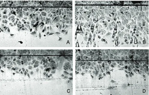 Figure 5. Inhibition of cell migration by Triamcinolone acetonide (TA). Effect of the RPE-conditioned medium on  human dermal microvascular endothelial cell (HDMEC) in migration assay