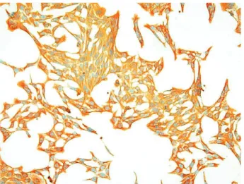Figure 3. Survival of R28 cells after exposed to SNAP for  1  day  in  serum-free  and  10%  serum-containing  media