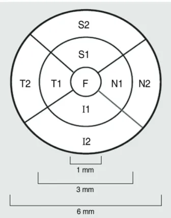 Figure  1. AREDS  grid  at  right  used  for  reporting  retinal  thickness (F=fovea; S1=superior inner;, N1=nasal inner; 