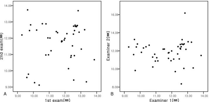 Figure 2. Scattergram showing intra- (A) and inter-examiner (B) repeatability of limbus to limbus diameter (nasal  –  temporal).