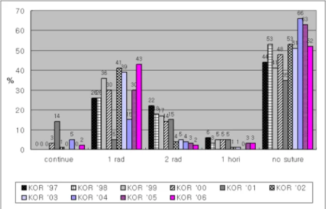 Figure 5. Incision modes in phacoemulsification. Temporal